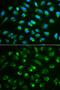 Interleukin 7 antibody, GTX55679, GeneTex, Immunofluorescence image 