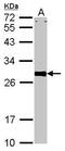 VAMP Associated Protein A antibody, PA5-22188, Invitrogen Antibodies, Western Blot image 