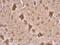 Collapsin Response Mediator Protein 1 antibody, PA5-34768, Invitrogen Antibodies, Immunohistochemistry frozen image 