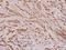 Immunoglobulin Heavy Constant Alpha 1 antibody, A07514Y276, Boster Biological Technology, Immunohistochemistry frozen image 