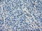 Crystallin Alpha B antibody, LS-C114678, Lifespan Biosciences, Immunohistochemistry frozen image 