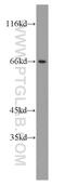 Carbonic Anhydrase 9 antibody, 11071-1-AP, Proteintech Group, Western Blot image 