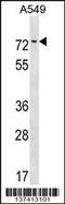 Zinc Finger Protein 875 antibody, 60-096, ProSci, Western Blot image 