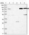 Coatomer Protein Complex Subunit Beta 1 antibody, PA5-57852, Invitrogen Antibodies, Western Blot image 