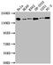 DOT1 Like Histone Lysine Methyltransferase antibody, CSB-RA238318A0HU, Cusabio, Western Blot image 
