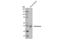 Cytochrome P450 Family 19 Subfamily A Member 1 antibody, 14528S, Cell Signaling Technology, Western Blot image 