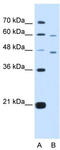 Cysteine Rich With EGF Like Domains 1 antibody, TA335941, Origene, Western Blot image 