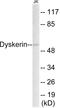 Dyskerin Pseudouridine Synthase 1 antibody, EKC1643, Boster Biological Technology, Western Blot image 