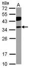 Phosphatidylinositol Transfer Protein Beta antibody, PA5-31358, Invitrogen Antibodies, Western Blot image 