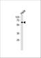 Nuclear Receptor Subfamily 1 Group D Member 2 antibody, A04958-1, Boster Biological Technology, Western Blot image 