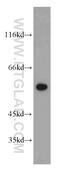 Chaperonin Containing TCP1 Subunit 4 antibody, 21524-1-AP, Proteintech Group, Western Blot image 