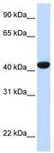 Fumarylacetoacetase antibody, TA346160, Origene, Western Blot image 