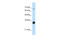 THO Complex 3 antibody, 29-481, ProSci, Enzyme Linked Immunosorbent Assay image 