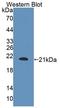 B And T Lymphocyte Associated antibody, LS-C374212, Lifespan Biosciences, Western Blot image 