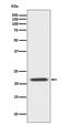 BH3 Interacting Domain Death Agonist antibody, M00730, Boster Biological Technology, Western Blot image 