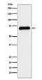 Sodium-dependent serotonin transporter antibody, M00496, Boster Biological Technology, Western Blot image 