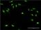 Gigaxonin antibody, H00008139-M01, Novus Biologicals, Immunofluorescence image 