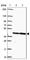 Carcinoembryonic Antigen Related Cell Adhesion Molecule 18 antibody, HPA059487, Atlas Antibodies, Western Blot image 