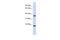 Transmembrane Protein 74 antibody, A15738, Boster Biological Technology, Western Blot image 