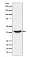 TARBP2 Subunit Of RISC Loading Complex antibody, M01680, Boster Biological Technology, Western Blot image 