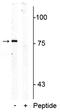 Solute Carrier Family 6 Member 4 antibody, P00496, Boster Biological Technology, Western Blot image 