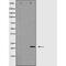 Claudin 4 antibody, GTX00667, GeneTex, Western Blot image 