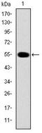 Interleukin 1 Receptor Associated Kinase 4 antibody, AM06659SU-N, Origene, Western Blot image 