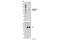 LCK Proto-Oncogene, Src Family Tyrosine Kinase antibody, 6943P, Cell Signaling Technology, Western Blot image 