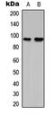 RNA Binding Motif Protein 5 antibody, LS-C358274, Lifespan Biosciences, Western Blot image 