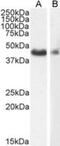 Actin Alpha 2, Smooth Muscle antibody, NB300-978, Novus Biologicals, Western Blot image 