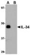 Interleukin 34 antibody, TA306635, Origene, Western Blot image 