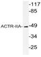 Activin A Receptor Type 2A antibody, AP20763PU-N, Origene, Western Blot image 