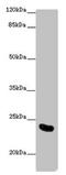 Activation Induced Cytidine Deaminase antibody, LS-C677093, Lifespan Biosciences, Western Blot image 