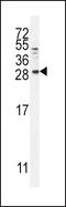 Betacellulin antibody, PA5-35064, Invitrogen Antibodies, Western Blot image 