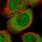 Trimethylguanosine Synthase 1 antibody, NBP1-92271, Novus Biologicals, Immunofluorescence image 