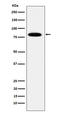 Minichromosome Maintenance Complex Component 7 antibody, M01649-2, Boster Biological Technology, Western Blot image 