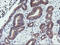 Protein Phosphatase 1 Regulatory Subunit 15A antibody, LS-C173755, Lifespan Biosciences, Immunohistochemistry paraffin image 