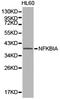 NFKB Inhibitor Alpha antibody, TA326981, Origene, Western Blot image 