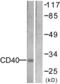 CD40 Molecule antibody, LS-C118600, Lifespan Biosciences, Western Blot image 
