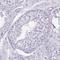 Solute Carrier Family 17 Member 7 antibody, NBP2-33597, Novus Biologicals, Immunohistochemistry paraffin image 