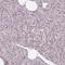 OMA1 Zinc Metallopeptidase antibody, NBP2-30971, Novus Biologicals, Immunohistochemistry paraffin image 