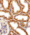 Membrane Palmitoylated Protein 7 antibody, A07143, Boster Biological Technology, Immunohistochemistry paraffin image 