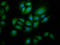 Ring Finger Protein 213 antibody, LS-C672616, Lifespan Biosciences, Immunofluorescence image 