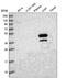S-adenosylmethionine synthase isoform type-1 antibody, HPA048627, Atlas Antibodies, Western Blot image 