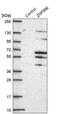 Zinc Finger Protein 596 antibody, PA5-63131, Invitrogen Antibodies, Western Blot image 