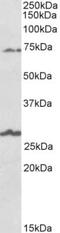 Solute Carrier Family 6 Member 12 antibody, NBP2-26172, Novus Biologicals, Western Blot image 