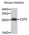 Colony Stimulating Factor 2 antibody, STJ27880, St John