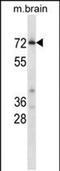 Cyclin Dependent Kinase 17 antibody, PA5-48702, Invitrogen Antibodies, Western Blot image 