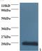 Cytidine Deaminase antibody, LS-C210986, Lifespan Biosciences, Western Blot image 