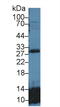 Glutathione S-Transferase Theta 2 (Gene/Pseudogene) antibody, MBS2013800, MyBioSource, Western Blot image 